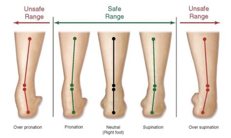 walking shoes to correct pronation.